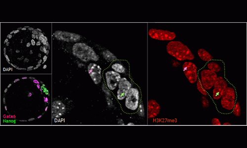 @INRAE A. Bonnet-Garnier : Embryon de souris à E3.75 / dapi (ADN), GATA6 (hypoblaste), Nanog (épiblaste pluripotent, entouré en pointillés verts) et H3K27me3